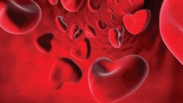 Anemia: O Problemă de Sănătate Publică în România și Noile Abordări în Tratament