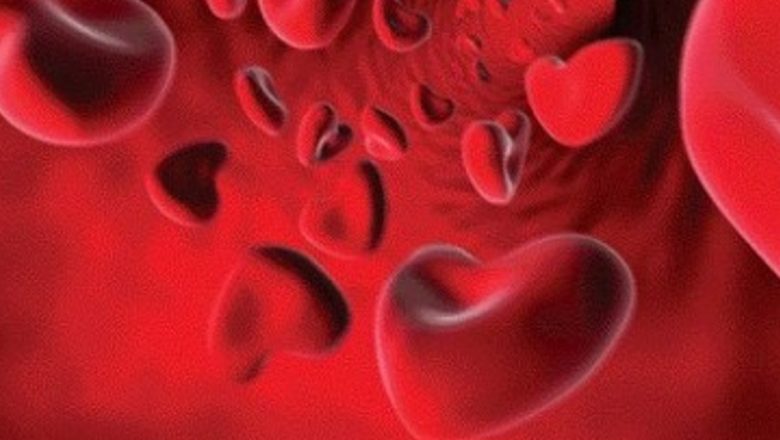 Anemia: O Privire Detaliată asupra Cauzelor, Tratamentului și Impactului Asupra Sănătății Publice