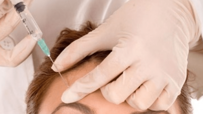 Inovații în tratamentele pentru căderea părului: Botox ca soluție revoluționară