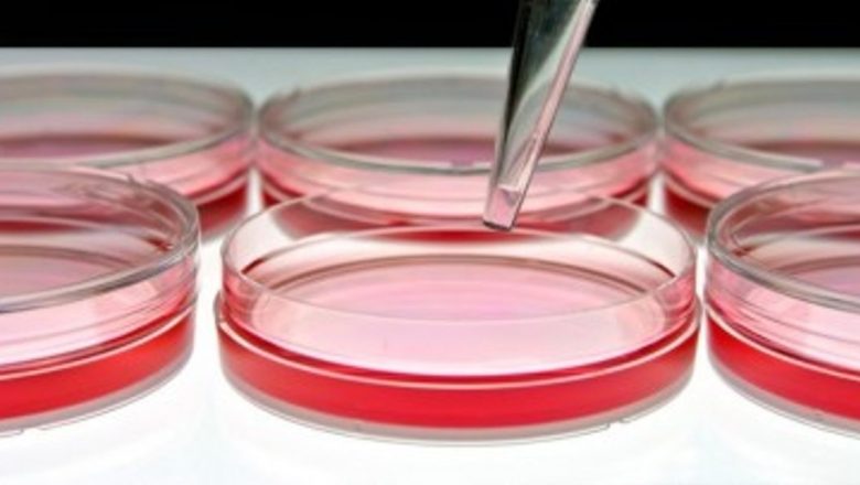 Inaugurarea Primei Academii HIV/SIDA din Europa: O Nouă Epocă în Lupta Împotriva Epidemiei