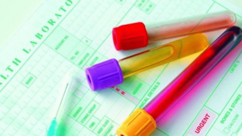 Revoluția Diagnosticării: Impactul Testului Rapid pentru Chlamydia Dezvoltat de Universitatea Cambridge