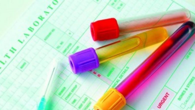 Inovație medicală: Testul rapid pentru depistarea Chlamydia și implicațiile sale asupra sănătății publice