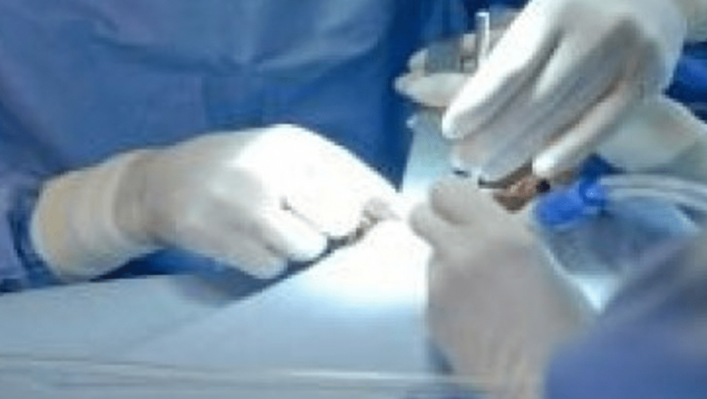 Inovație în Medicină: Operații Cerebrale prin Nări – O Revoluție în Tratamentul Afecțiunilor Neurologice