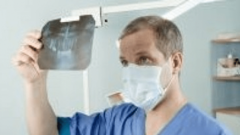 Revoluția în Tratamentul Cancerului Pulmonar: O Nouă Speranță pentru Pacienți