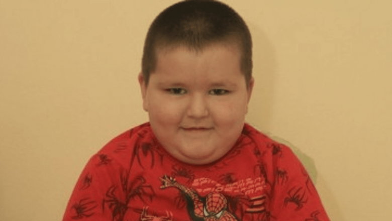 Provocările alimentației sănătoase la copii: cazul lui Alex și impactul dulciurilor asupra sănătății infantile