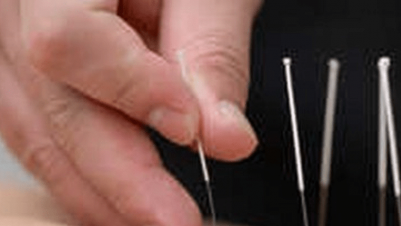 Acupunctura: O soluție inovatoare pentru depășirea fobiei de stomatolog