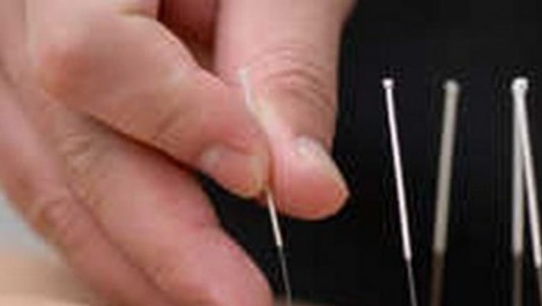 Acupunctura: O Soluție Inedită pentru Fobia de Stomatolog