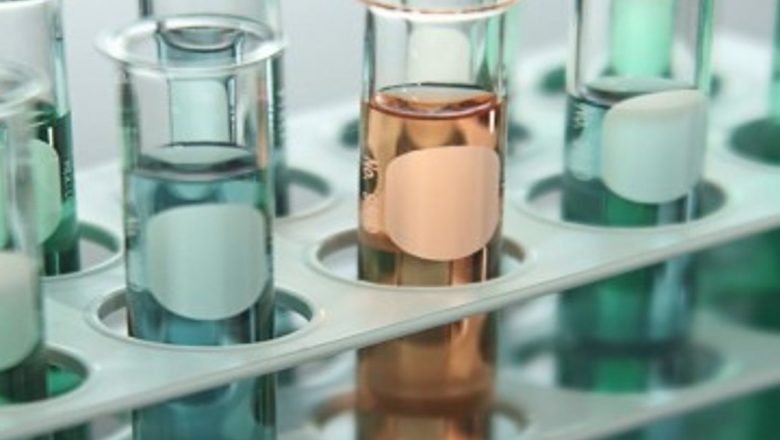Inovații în diagnosticarea cancerului de colon: Testul de urină promițător al cercetătorilor de la Universitatea din Carolina de Nord
