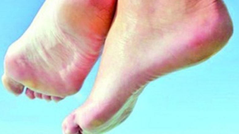 Remedii Naturale pentru Călcâiele Crăpate: Soluții Eficiente și Beneficii pe Termen Lung