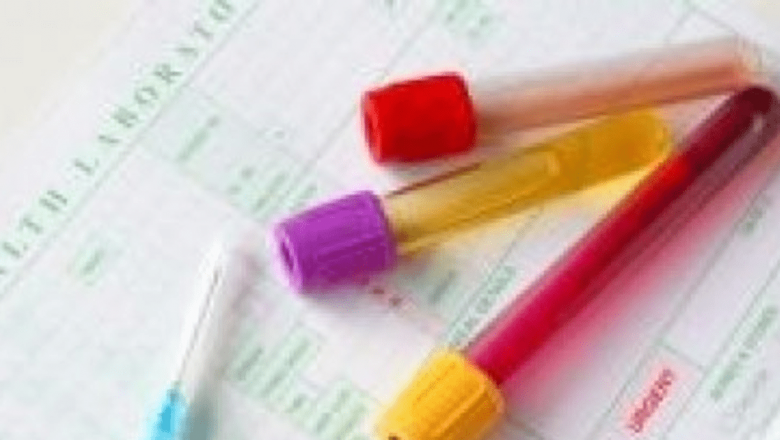 Inovații în Depistarea Cancerului Ovarian: O Metodă Promițătoare în Lupta Împotriva Unei Boli Insidioase