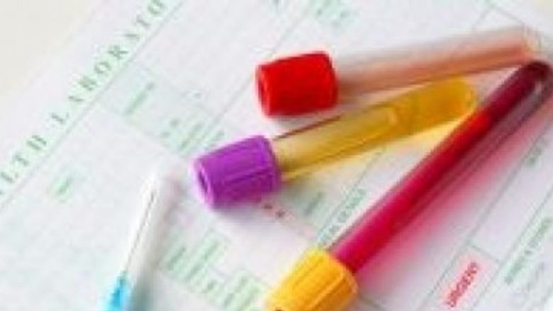 Noutăți promițătoare în depistarea cancerului ovarian: O metodă revoluționară în testare