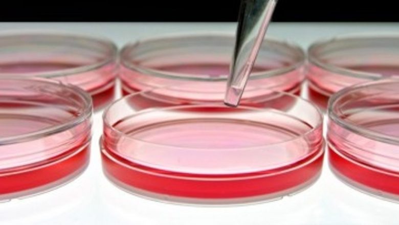 Revoluția regenerării cardiace: Descoperirea telocitelor și impactul lor asupra sănătății inimii