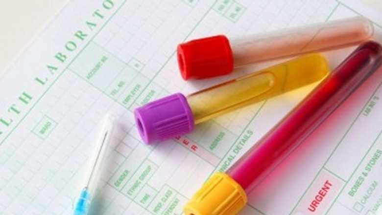 Inovație în depistarea diabetului: Testul care poate anticipa riscurile cu 10 ani înainte