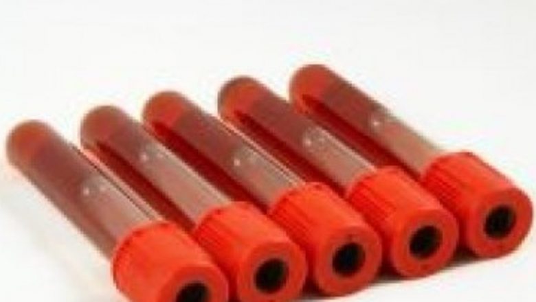 Revoluția Testelor de Sânge Prenatale: O Privire Asupra Viitorului Medicinii și Dilemelor Etice
