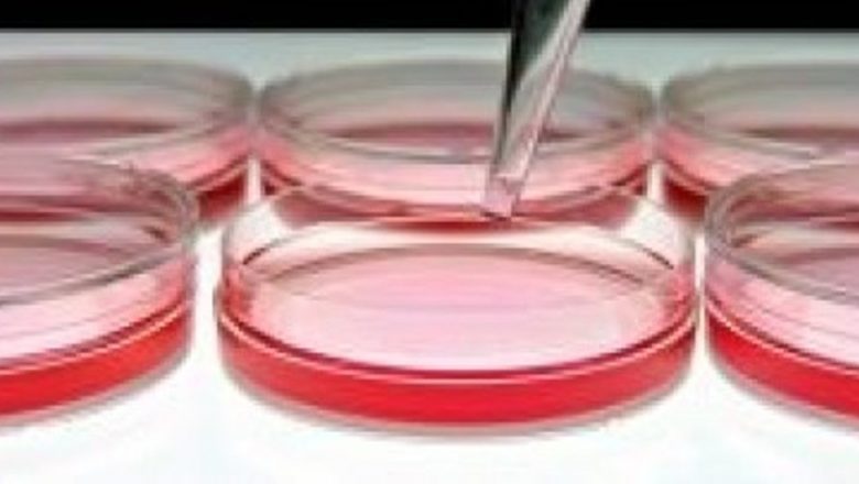 Progrese în diagnosticarea timpurie a bolii Alzheimer: O nouă tehnologie promite rezultate promițătoare
