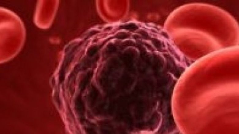 Impactul Estrogenului asupra Cancerului din Zona Capului și Gâtului: O Analiză Detaliată
