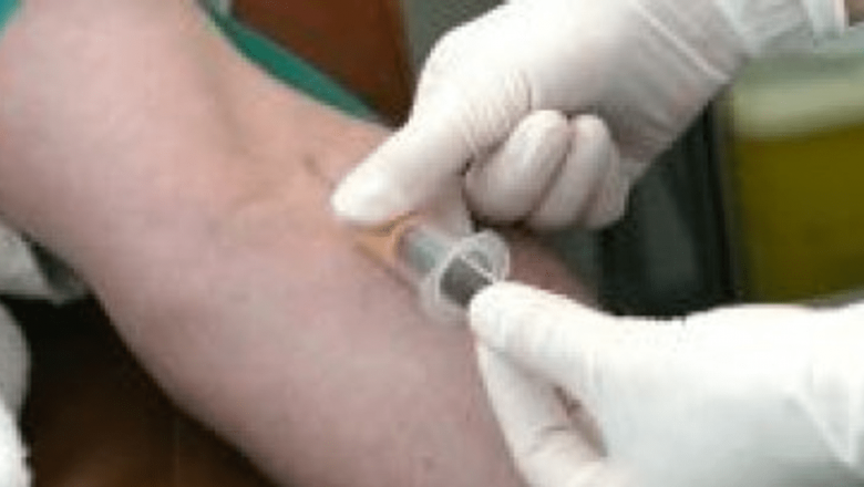 Campania Națională de Testare Gratuită pentru Hepatita C: O Inițiativă Vitală în Combaterea unei Epidemii Tăcute