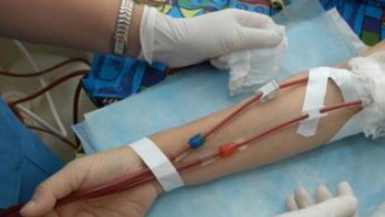 Impactul Dializei asupra Sănătății Cardiovasculare: Atunci Când Trei Ședințe pe Săptămână Nu Sunt Suficiente