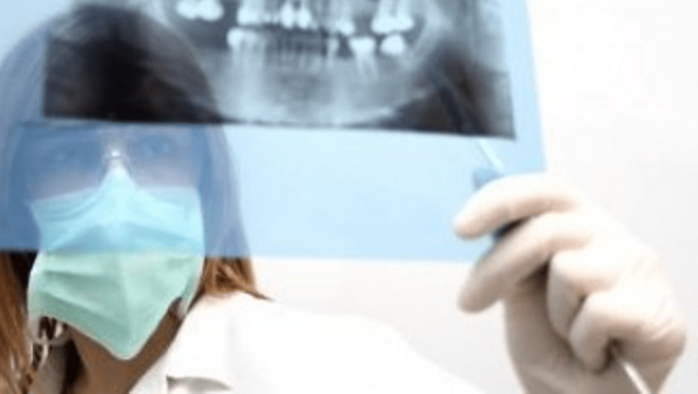 Radiografiile dentare și riscurile ascunse: legătura cu tumorile cerebrale