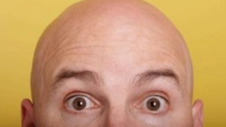Relația dintre chelie și riscul crescut de cancer de prostată: O analiză detaliată