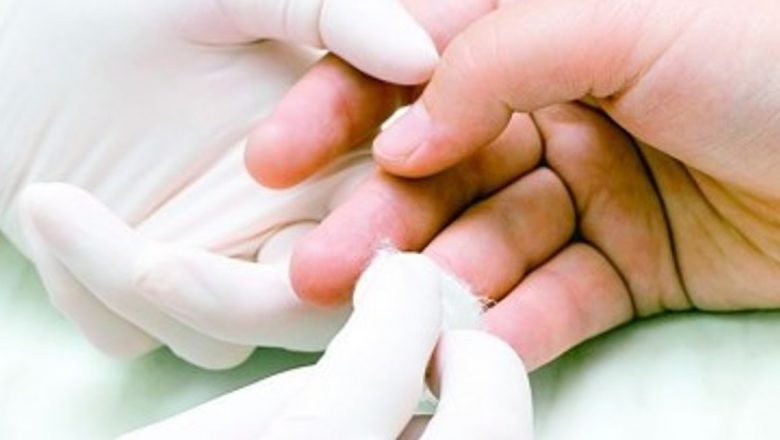 Eczemele: O Privire Detaliată Asupra Cauzelor, Impactului și Strategiilor de Gestionare