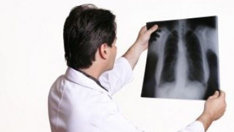 Campania de Informare privind Cancerul Pulmonar: O Luptă Esențială pentru Sănătatea Publică