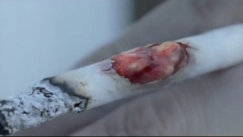 Impactul unei reclame controversate: Fumatul, cancerul și efectele vizuale ale unei campanii de conștientizare