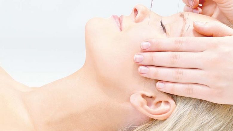 Acupunctura: O Soluție Eficientă pentru Durerile Cronice și Stresul Cotidian