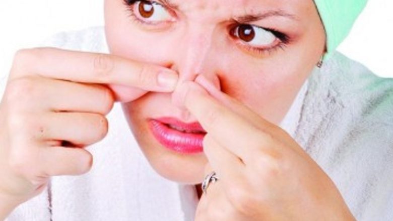 Tot ce trebuie să ştiţi despre acnee: Mituri, cauze şi tratamente