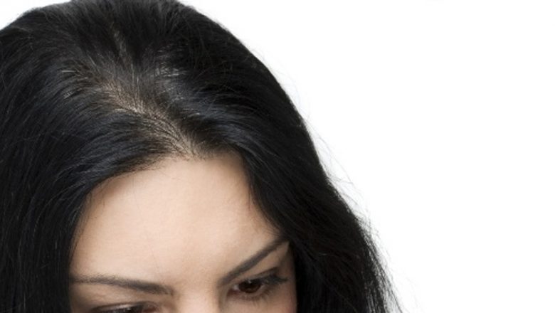 Mituri comune despre căderea părului: Adevăruri și realități