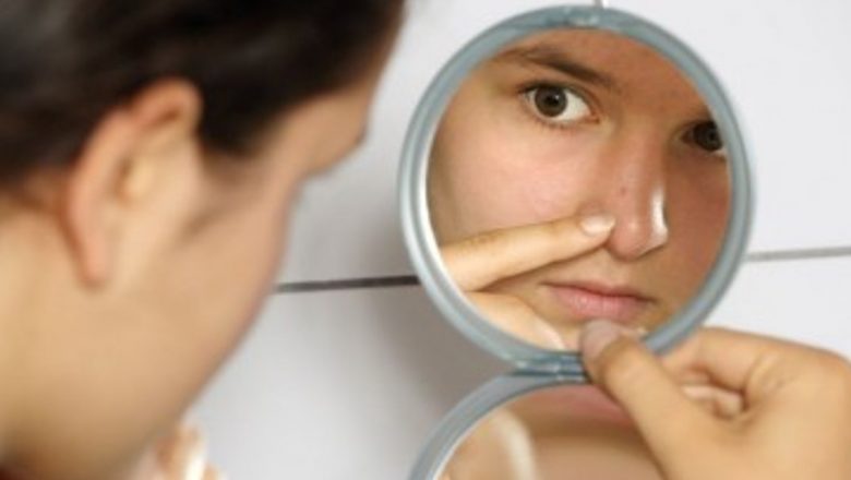 Cum să Abordezi Corect Acneea: Ghid Complet pentru Tratament Eficient