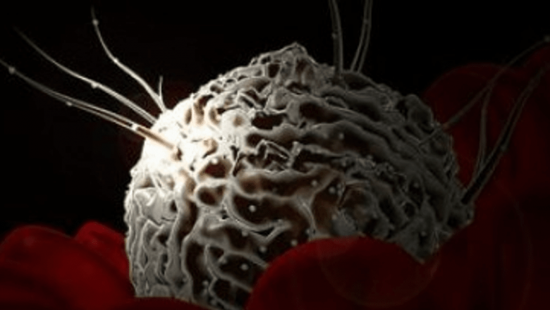 O Revoluție în Lupta Împotriva Cancerului: Imunoterapia cu Celule Stem și Celulele T