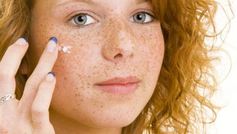 Remedii Naturale pentru Pistrui: Soluții Eficiente și Sănătoase pentru Tenul Tău