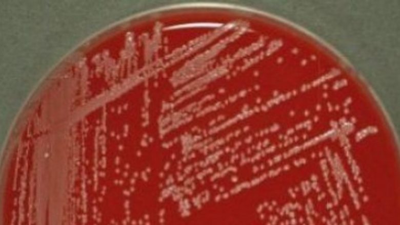 Cresterea Rezistentei Bacteriene la Antibiotice: O Provocare Globală și Implicațiile Sale în România