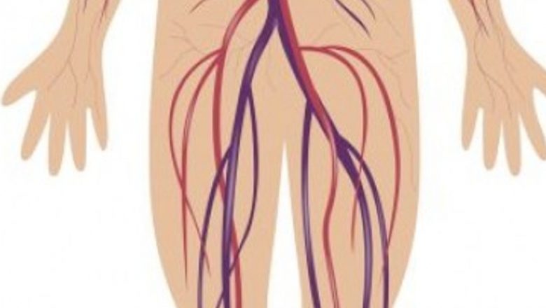 Inovație revoluționară în chirurgia cardiacă: Procedura hibridă pentru anevrismul aortei abdominale