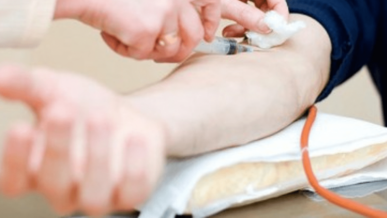 Revoluția în Diagnosticul Cancerului Pulmonar: Un Test de Sânge Promițător care Ar putea Schimba Viitorul
