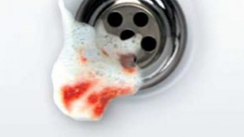 Impactul Sângerării Gingivale: Cauze, Consecințe și Importanța Îngrijirii Dentare