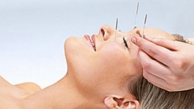 Explorarea acupuncturii: 4 probleme pe care le putem trata prin această terapie tradițională