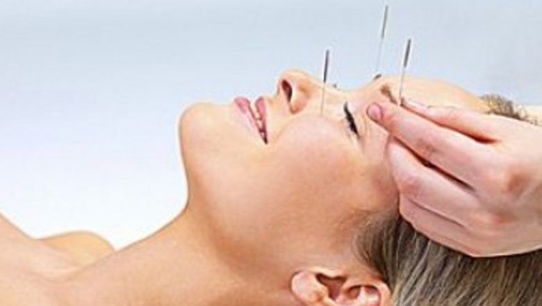 Acupunctura: O Soluție Holistică pentru Patru Probleme Comună de Sănătate