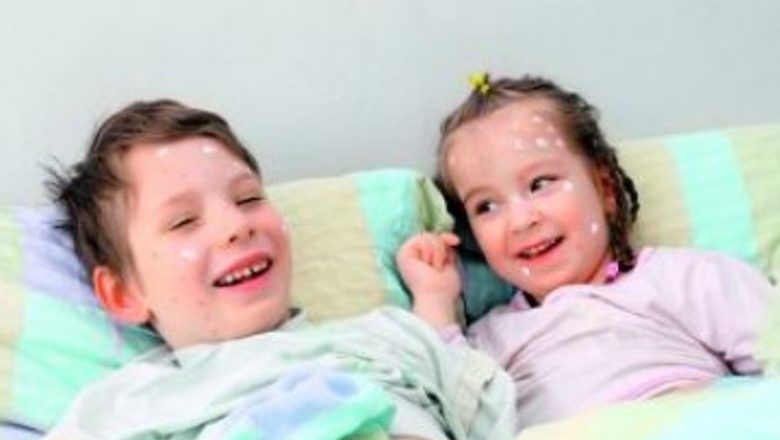 Ghidul complet pentru îngrijirea copilului cu varicelă: simptome, tratamente și recomandări esențiale