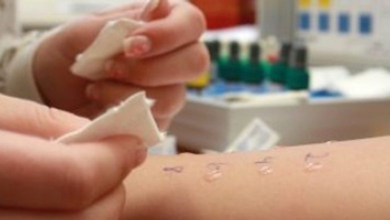 Rinita alergică: Diagnosticare, teste și implicații pentru sănătate