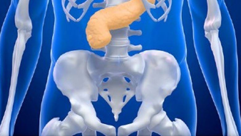 Cresterea alarmantă a cazurilor de cancer pancreatic: o analiză a statisticilor și implicațiilor pentru sănătate