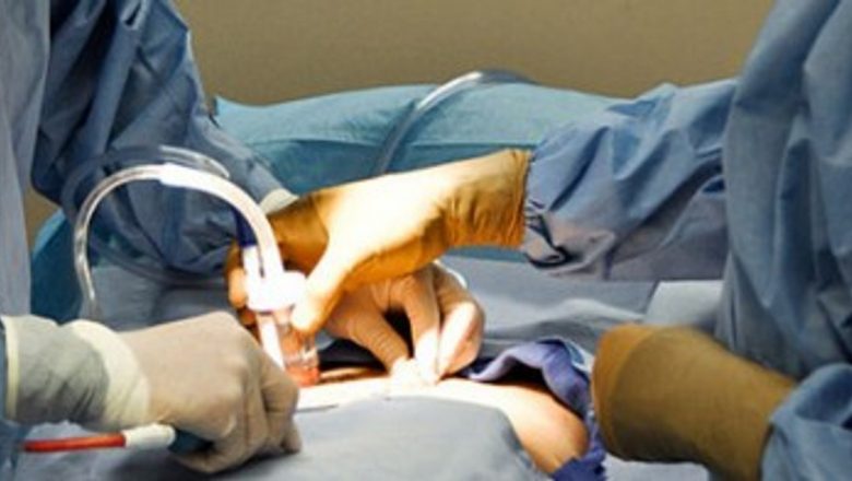 Liposucția: O soluție estetică sau un risc ascuns?