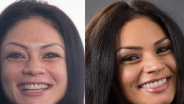 Transformarea Zâmbetului: Fațetele Dentare Ceramice și Impactul Lor Asupra Esteticii Dentare