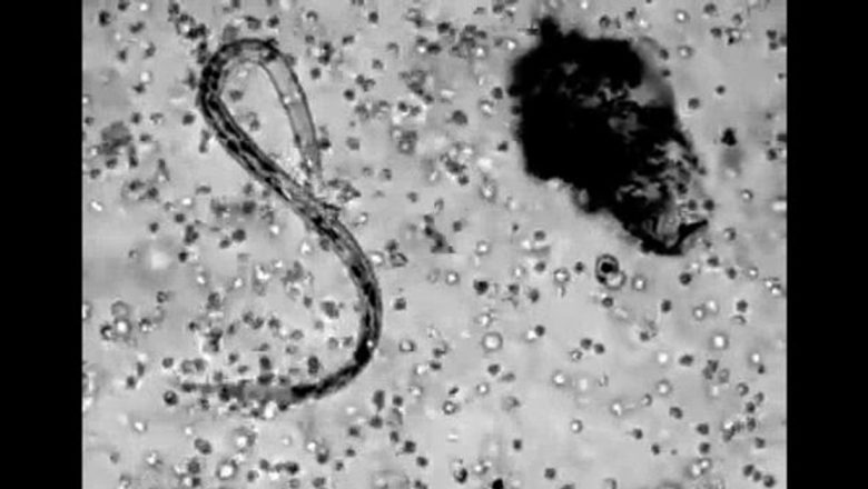 Celulele Sângelui: Apărătorii Noștri Împotriva Infecțiilor