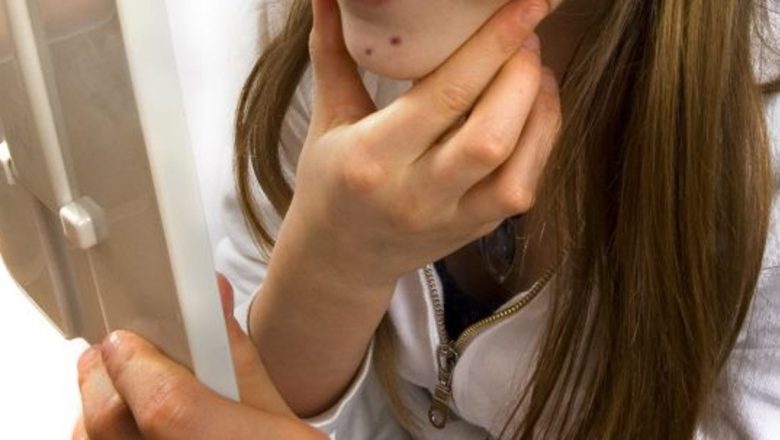 Strategii Naturale și Medicinale pentru Combaterea Herpesului: O Abordare Completă