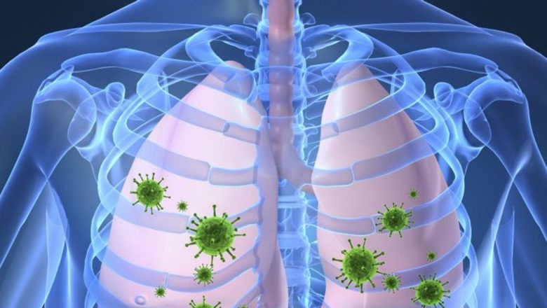 Pneumonia: Semne Subtile și Impactul Asupra Sănătății Publice