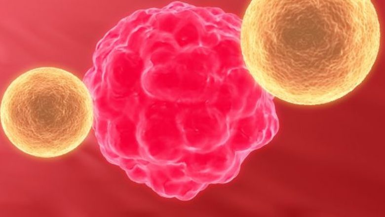 Strategii Inedite pentru Prevenirea Cancerului: Alimentație, Activitate Fizică și Modificări de Stil de Viață