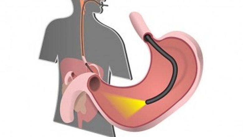Totul despre endoscopie: O investigație esențială pentru sănătatea digestivă