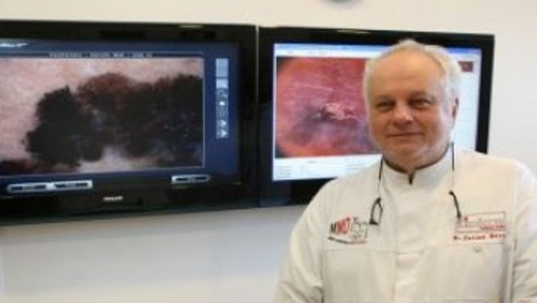 Creșterea alarmantă a melanomului în România: O privire detaliată asupra unei probleme de sănătate publică